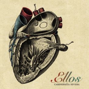 Cardiopatía Severa album cover