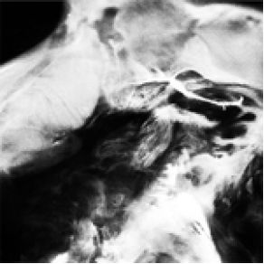 A New Life Part II - New Life album cover