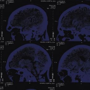 Mind Over Matter album cover
