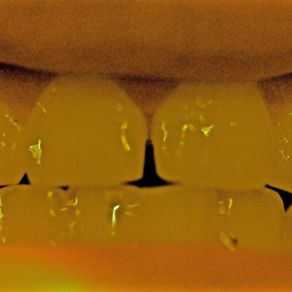 Azul, Mis Dientes album cover