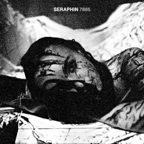 7665 album cover