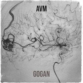 Avm album cover